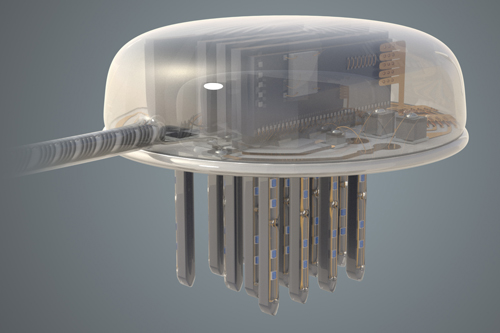Artists impression of the CANDO brain implant